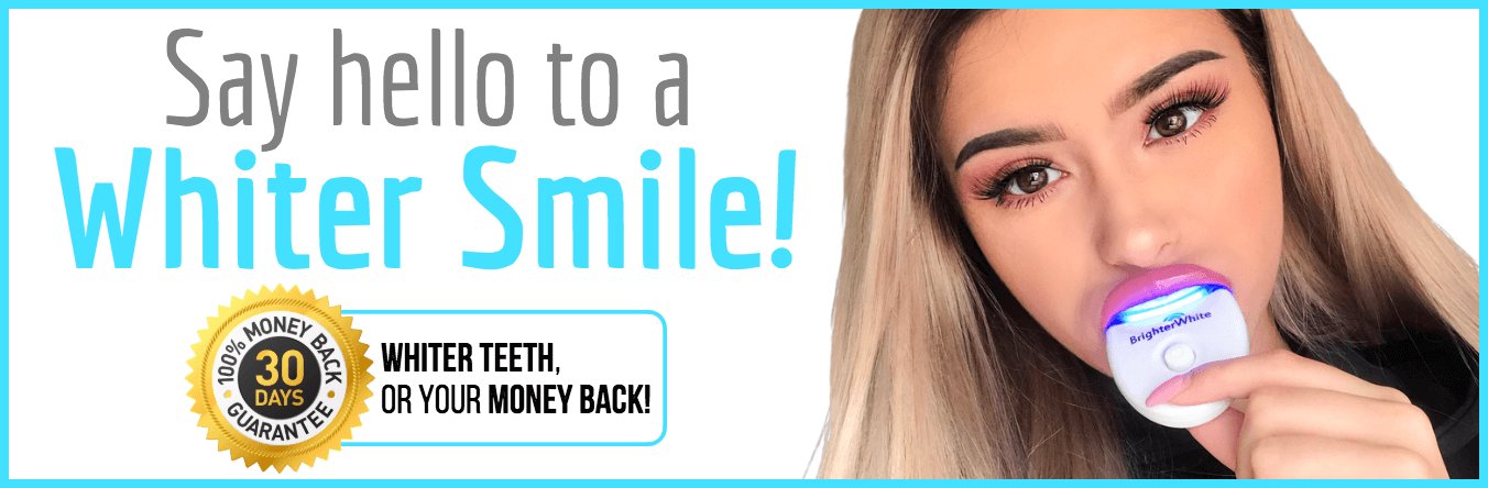 best teeth whitening kits