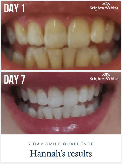 Hannah - day 1 vs day 7 result