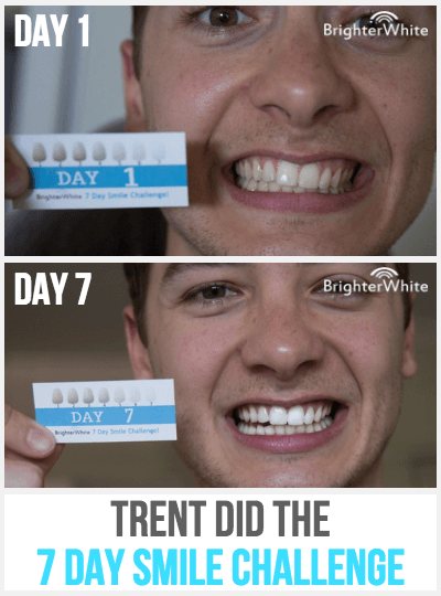 Day 1 vs day 7 customer result