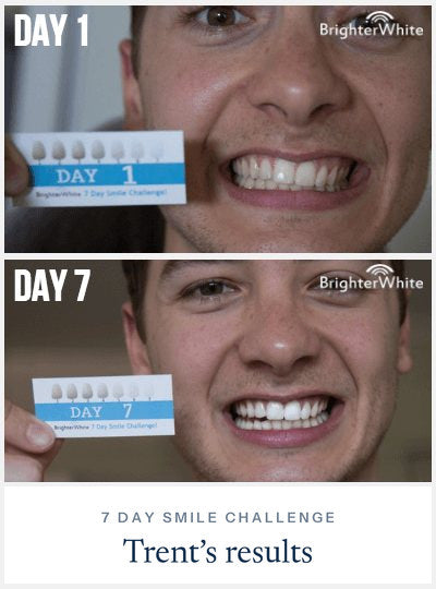 Trent - day 1 vs day 7 result