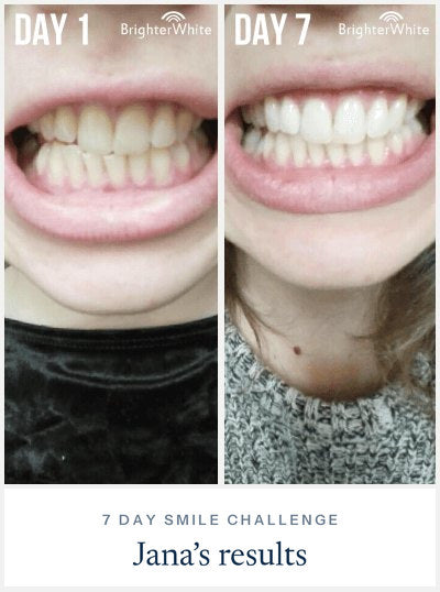 Jana · 7 Day Smile Challenge