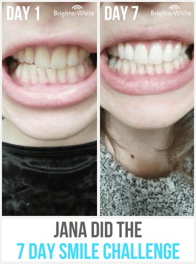 Jana · 7 Day Smile Challenge