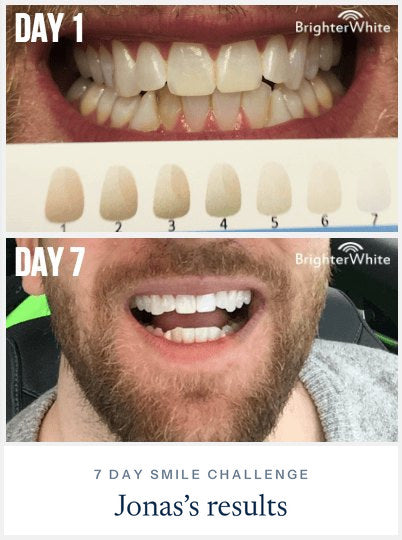Jonas · 7 Day Smile Challenge