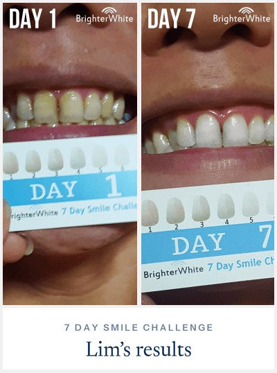 Lim · 7 Day Smile Challenge