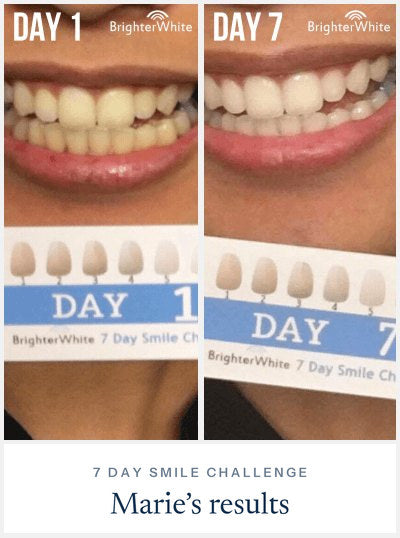Marie · 7 Day Smile Challenge
