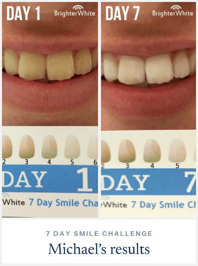 Michael · 7 Day Smile Challenge