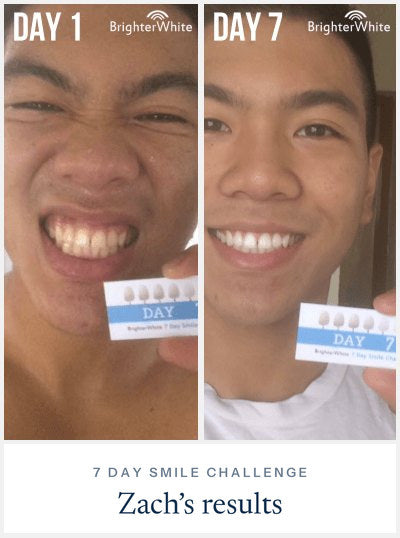 Zach · 7 Day Smile Challenge