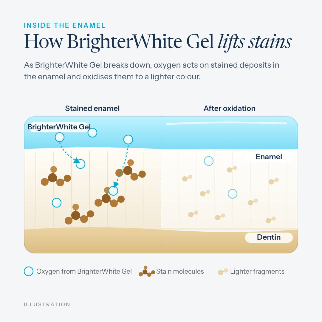 Illustration: how BrighterWhite Gel lifts stains - oxygen from the gel oxidises stain molecules in the enamel to a lighter colour