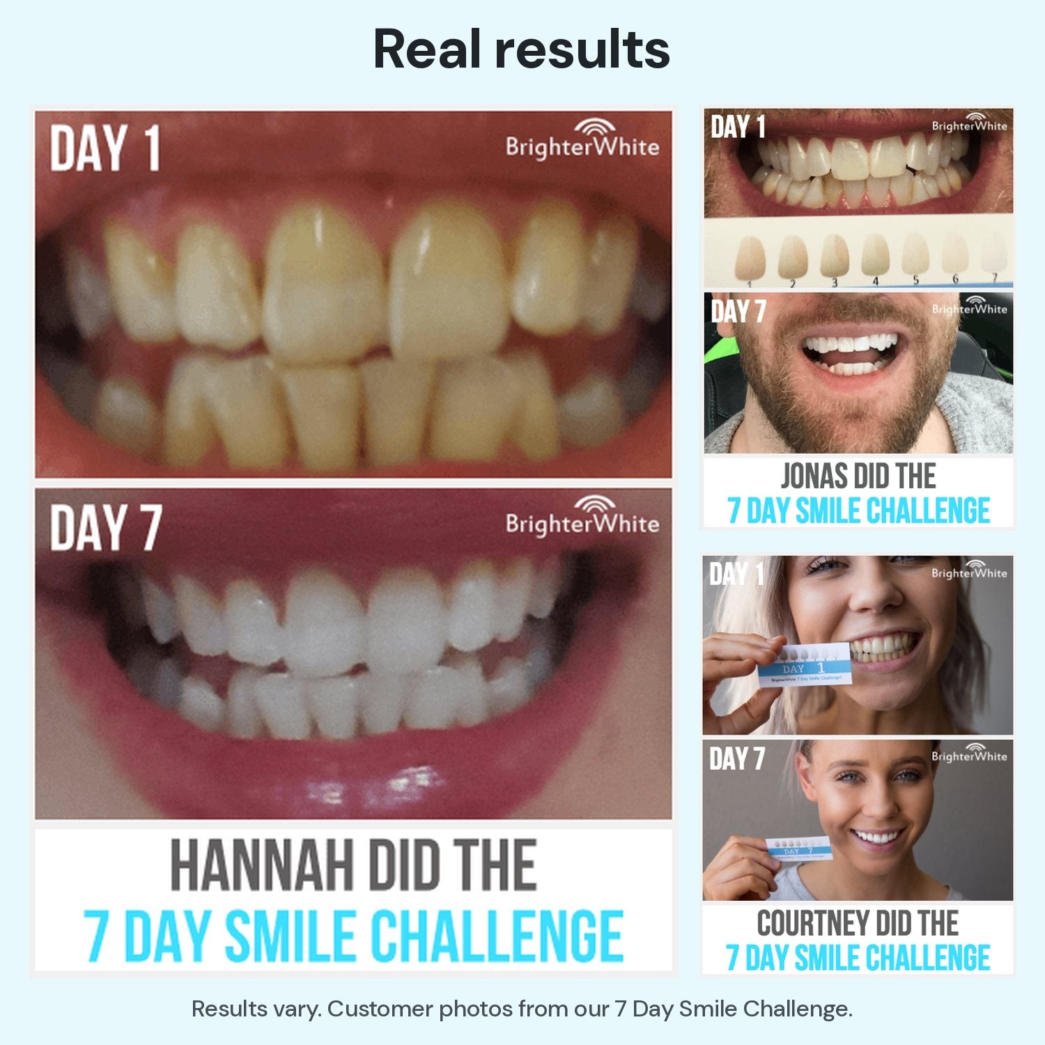 Real Day 1 and Day 7 results from 3 customers in our 7 Day Smile Challenge - results vary