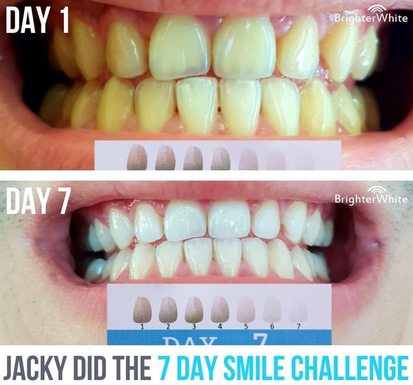 Jacky - customer before and after photo