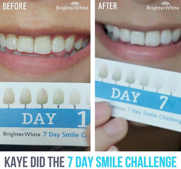 Kaye - customer before and after photo