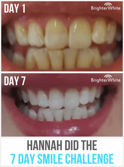 Hannah · 7 Day Smile Challenge