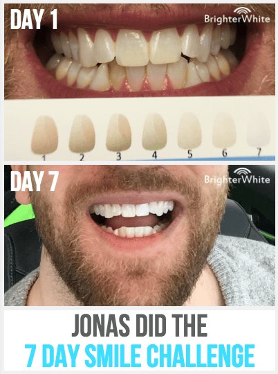 Jonas · 7 Day Smile Challenge