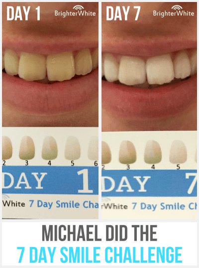 Michael · 7 Day Smile Challenge