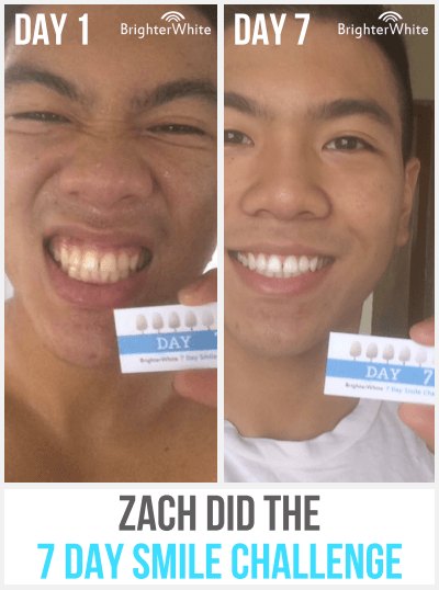 Zach · 7 Day Smile Challenge