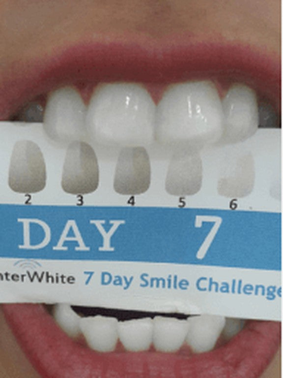 Day 7
