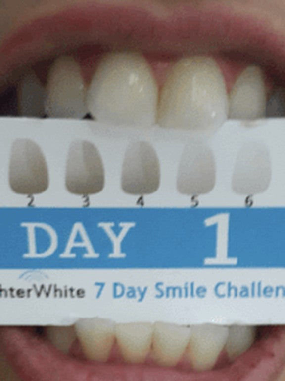 Day 1